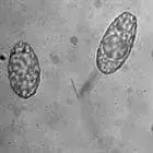 Spore image mushroom spore image